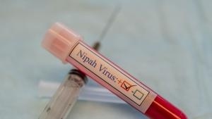 Опасен, но не пандемичен: Как се разпространява вирусът Нипа