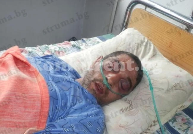 Един с опасност за живота след кърваво меле