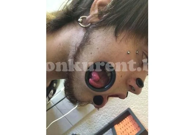 /СНИМКИ18+/ Надупчен изрод взриви мрежата