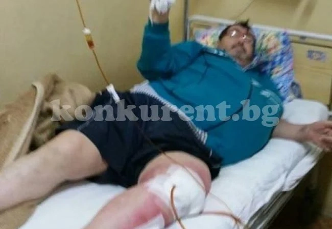 За малко да отрежат крака на Митьо Пищова!