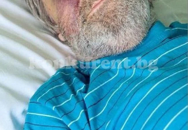 Пребили зверски дядо Наньо, полицията е по петите на извършителите