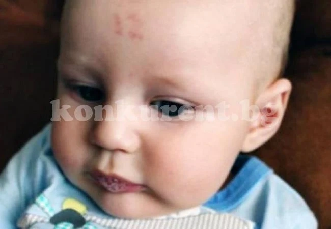 Роди се бебе с числото 12 на челото