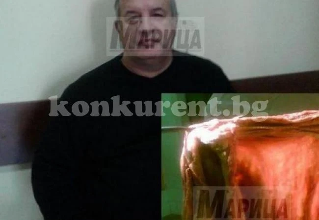 Пациент с парцал в корема дочака справедливост след 11 години (СНИМКИ, 18+)