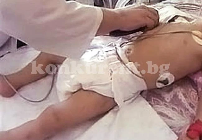Дете на 2 години бере душа със счупени ребра и повреден далак