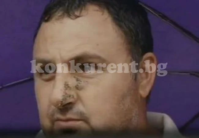 Ето я жертвата на свирепия питбул
