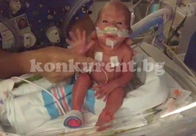 Жена с болнична сметка от 1 милион за преждевременно раждане