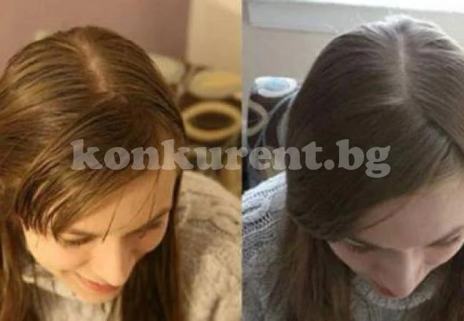 Експеримент с поразителен ефект: Момиче спря шампоана за 6 месеца