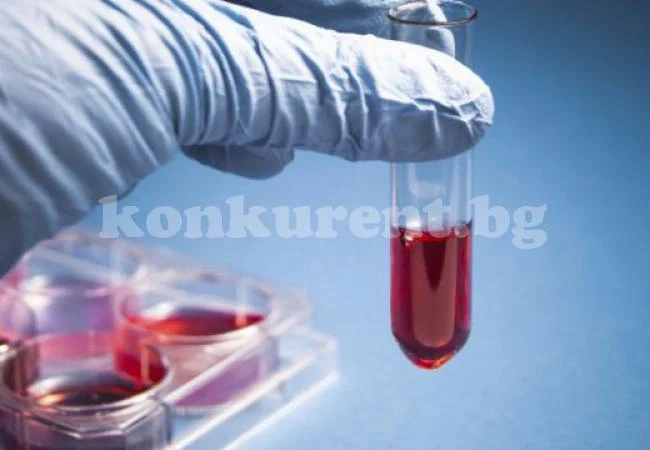 Сензационно откритие! Кръвен тест показва кога ще умрем