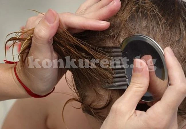 Въшки налазиха училищата след първия звънец