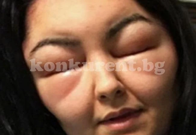 Жена си боядиса косата и едва не умря