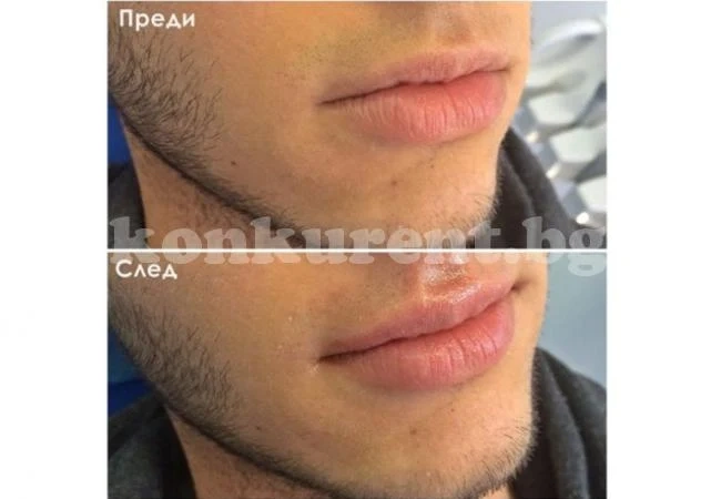 И мъжете вече помпат джуки
