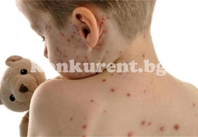 Шарки върлуват предколедно във Враца