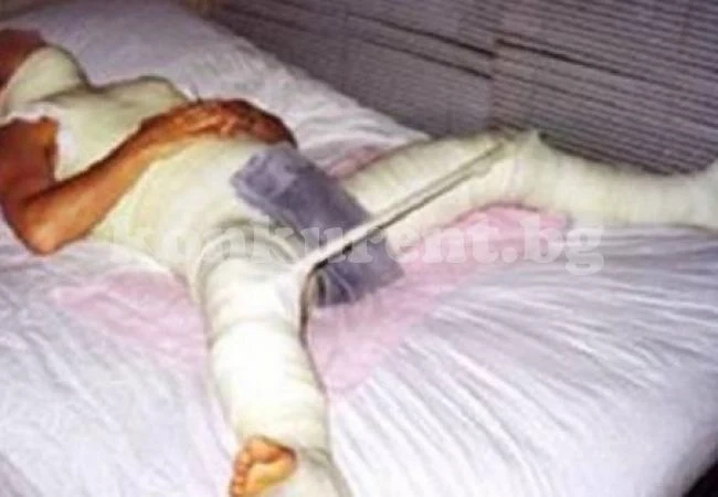 Извратеняк, опитал да прави секс с питбул, остана без пенис