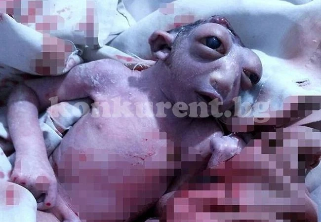 „Бебе чудо” се роди с половин глава и изцъклени очи