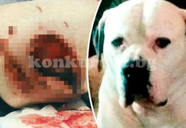 Куче на Дявола изгриза до кост крака на 10-годишно момче (СНИМКИ 18+)