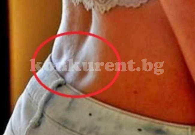 Ако имате тези две дупчици на гърба, вие сте наистина специални