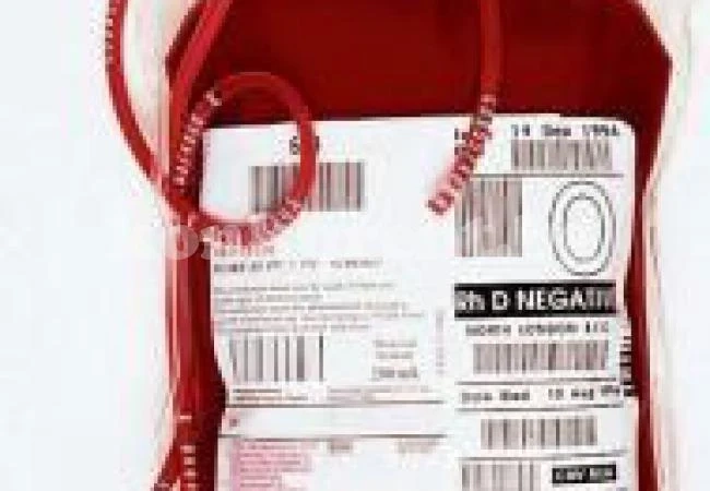 Внимавайте, ако ви преливат кръв! Може да се заразите с...