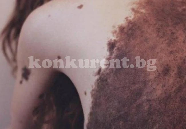 Докторите казваха, че няма надежда за това бебе! 26 г. по-късно всичко беше различно! (СНИМКИ)
