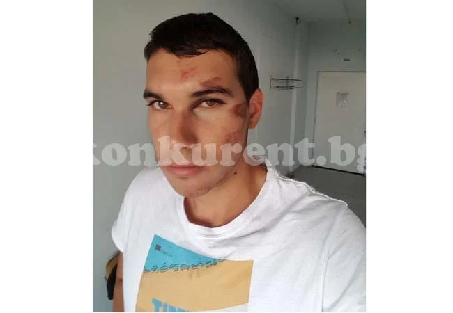 Нападнаха известен спортист и брат му