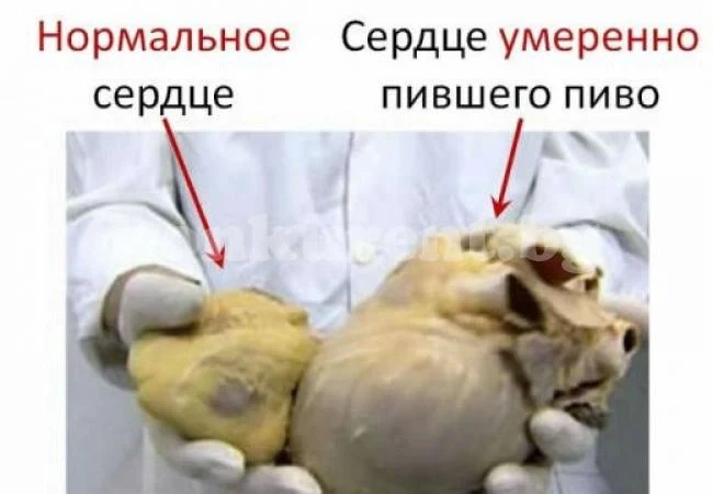 Учените с ново шокиращо 20: Бирата убива младите, други ги прави обратни