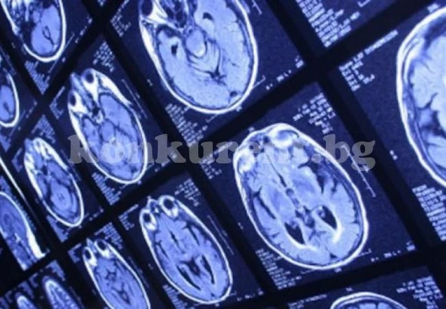 Жена започна да разговаря с Дева Мария след мозъчен тумор