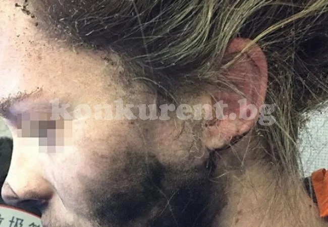Слушалки гръмнаха в главата на жена