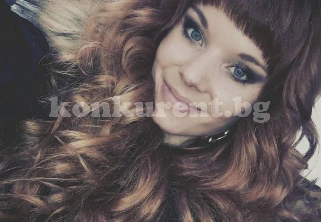 Тази ослепителна красавица страда от много рядка болест, която постепенно унищожава тялото й (СНИМКИ 18+)