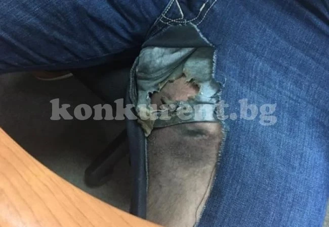 Мъж си пъхна iPhone в гащите, той се взриви на милиметри от семейните му бижута (СНИМКА)