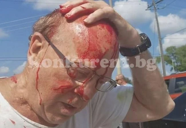 Развилнял се шофьор преби брутално и окървави колоездач (СНИМКИ/ВИДЕО 18+)