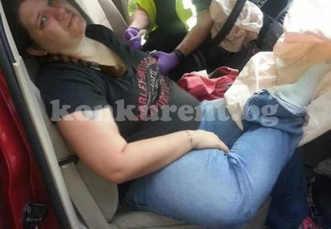 Тази ужасна история показва защо не трябва да си слагате краката на таблото на колата, докато пътувате (СНИМКИ)