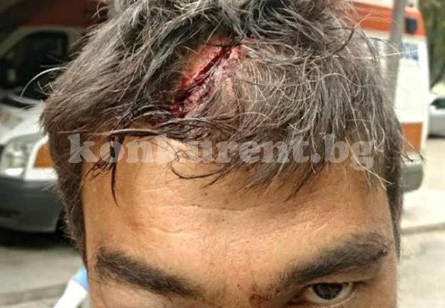 В Галиче пребиха жестоко свидетел срещу Ценко Чоков