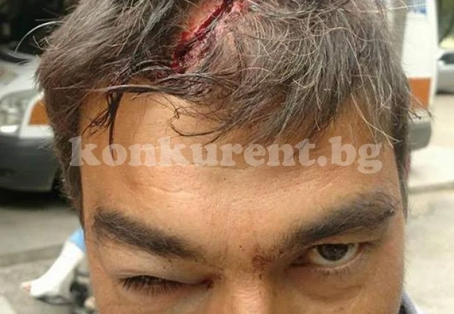 Полицията потвърди, че пребитият в Галиче е с опасност за живота