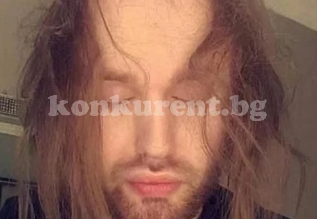 Той остана без коса и се отказа от секса, но после стана гей и... (СНИМКА)