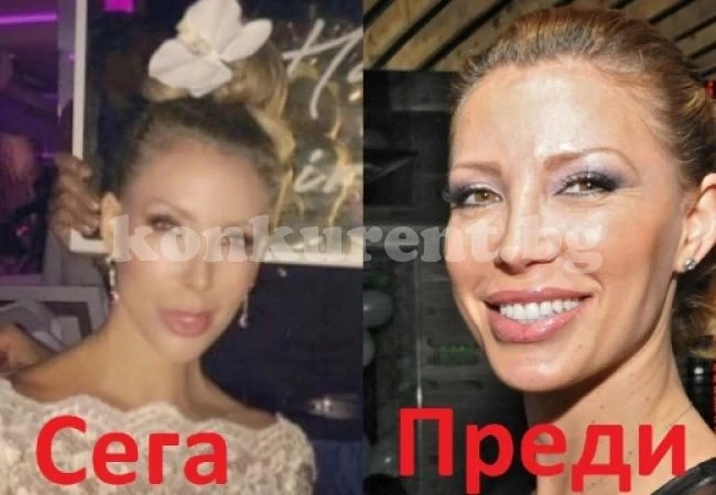 Ирен Онтева остана без нос! Последната й СНИМКА хвърли всички в шаш