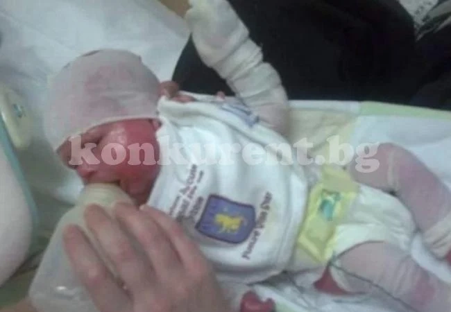 Момче се роди със страшна болест, цял живот го сочат с пръст и му се смеят, а то... (СНИМКИ)