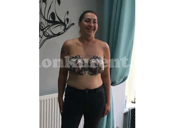 Жена отпразнува победата си над рака по невероятен начин (СНИМКИ 18+)  
