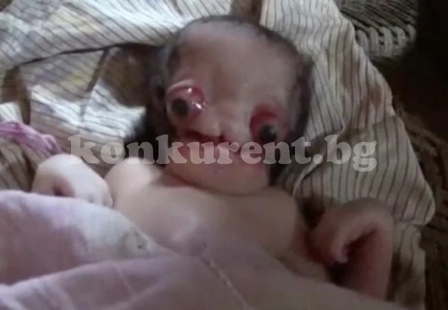 Почина бебето, което втрещи цял свят и накара мнозина да го обявят за извънземно