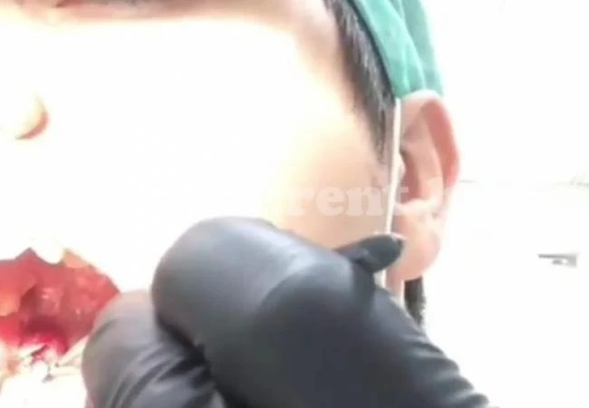 Сръчен зъболекар хвана инструментите и ... сам си извади зъба