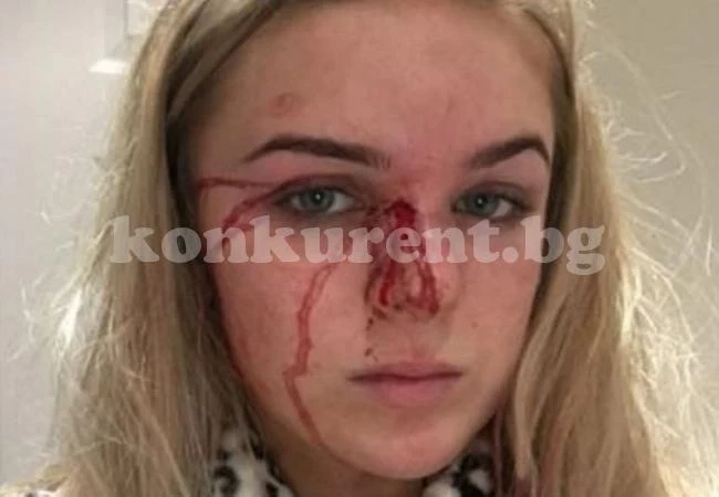 Млада красавица цяла година позволяваше на своя приятел да я пребива и изнасилва, но най-накрая се измъкна с хитрост (СНИМКИ 18+)