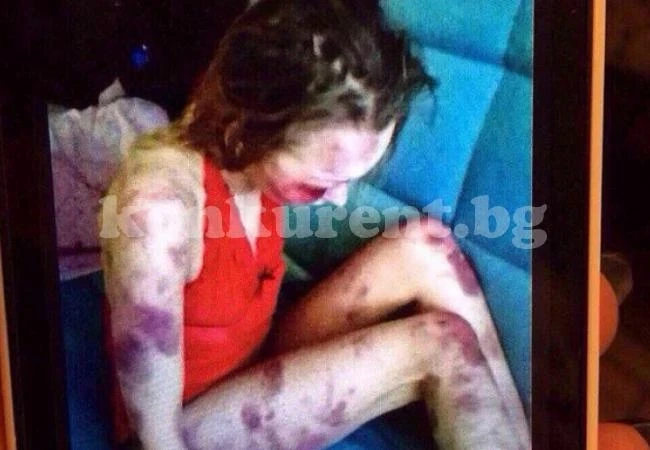 Ревнив съпруг преби жена си до смърт, а след това изпрати снимка от бруталната атака на приятелите си (СНИМКИ/ВИДЕО 18+) 