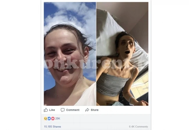 Фейсбук цензурира разтърсваща СНИМКА (18+) на млада жена, умираща от рак  