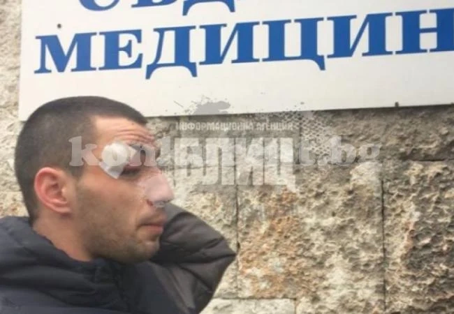 Ченгета смляха от бой младеж, дават му да пие вода от спринцовка