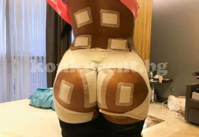 Жена брои 15 000 паунда за ново дупе и сега съжалява жестоко (СНИМКИ)