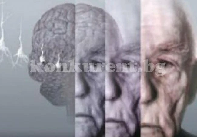 Пет несериозни болести, които ни състаряват 15 години по-рано