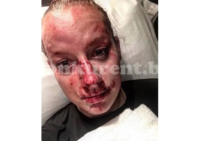 Млада полицайка показа цената на залавянето на откачил наркоман (СНИМКИ)