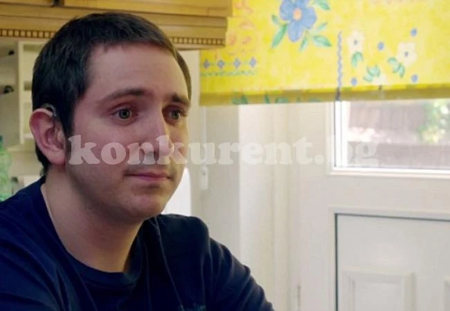 Този човек е алергичен към слънцето, но вече спокойно излиза навън, само слага... (СНИМКИ/ВИДЕО)