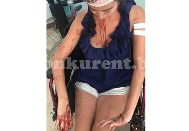 Чистачка преби зверски туристи с метален прът, защото отказали да платят повече пари (СНИМКИ 18+)