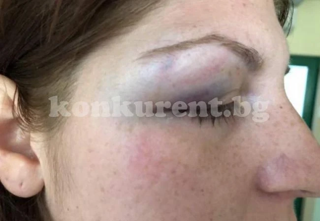 (СНИМКИ 18+) Подивелият Ангел смля от бой Пенка - блъскал я с вратата на колата