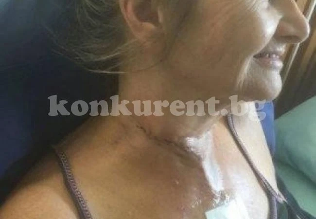 Пенсионерка си пускаше въдичката от лодка, риба изскочи от водата и я закла като касапин (СНИМКИ)