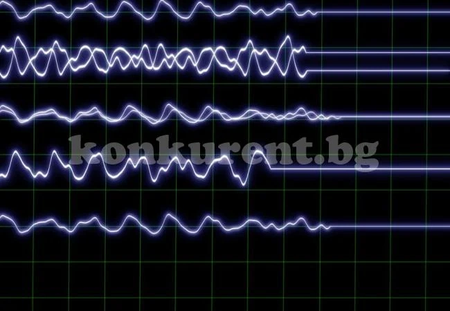 Какво се случва в тялото и съзнанието, когато сърдечната дейност спре